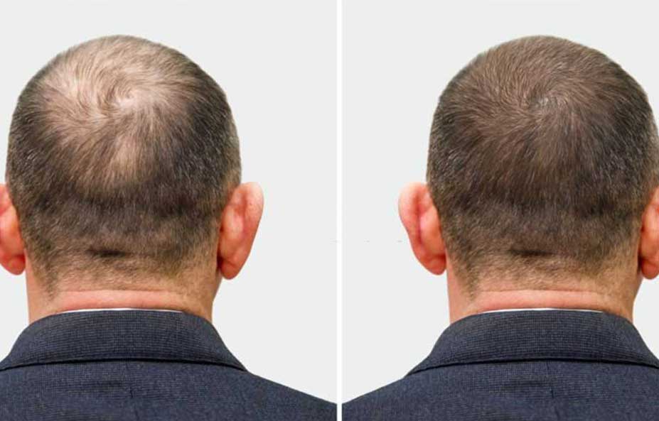 sac-ekim-hizmetleri-02-02