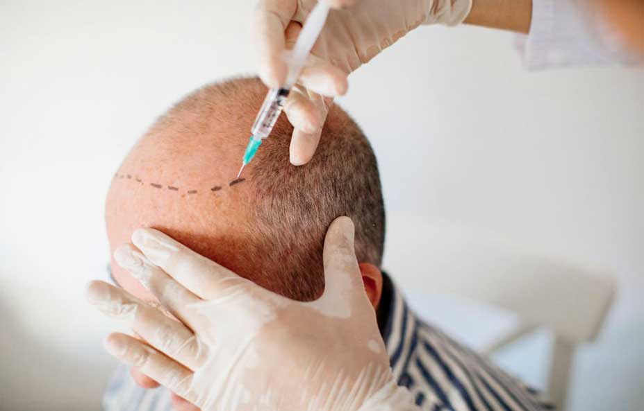 sac-ekim-hizmetleri-04